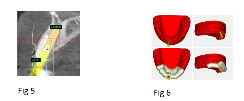 figures5-6.jpg